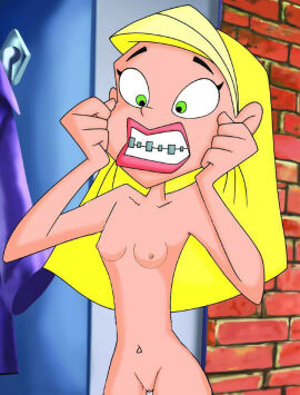 Braceface Naked