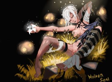 1girls android arms_behind_back bandage bare_shoulders barefoot breasts canon_futa dress_lift dress_pull feet feet_up female female_only flaccid foot_worship foreskin futanari grass groping_breasts inspection intersex kaine_(nier) moltenseal_(artist) nier:_automata penis ripped_clothing ripped_pantyhose robot shaved_crotch short_hair small_breasts small_penis stripped sunlight toes_spread uncircumcised unconscious video_games white_body white_hair