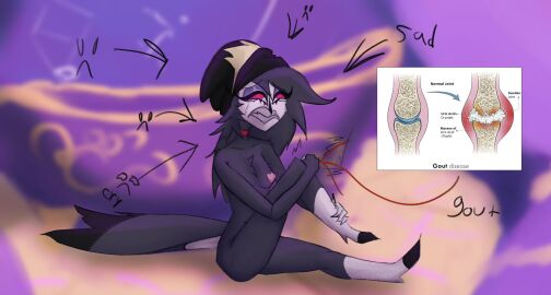 anthro areola ass avian beak bird breasts choker crying feathers female gout hair hat helluva_boss joints knee_pain knees lumbago masses_of_uric_acid nipples nude octavia_(helluva_boss) owl owl_demon pain red_eyes sad sobbing solo swollen_joint uric_acid uric_acid_crystals white_body