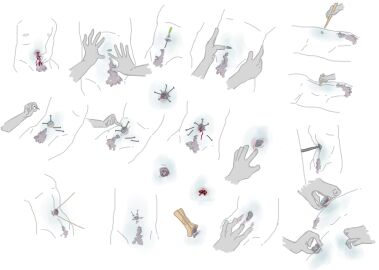 1boy anthro bodily_fluids body_hair disembodied_hand disembodied_mouth duo faceless_character faceless_male forced_outie happy_trail hi_res male male_only mammal navel navel_fetish navel_torture needleplay poking twomornings